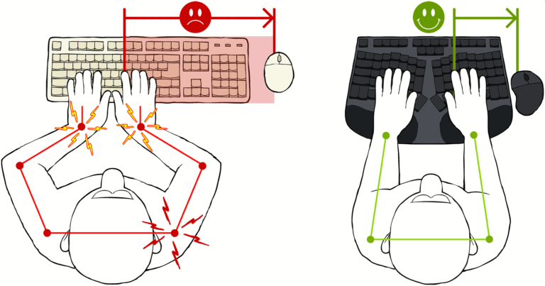 Truly Ergonomic Cleave - Reduce Conventional Typing Pain in Wrists and Shoulder