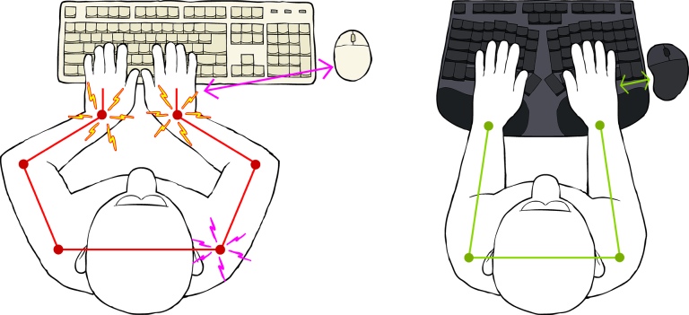 Truly Ergonomic Cleave Reduce Conventional Keyboard Pain
